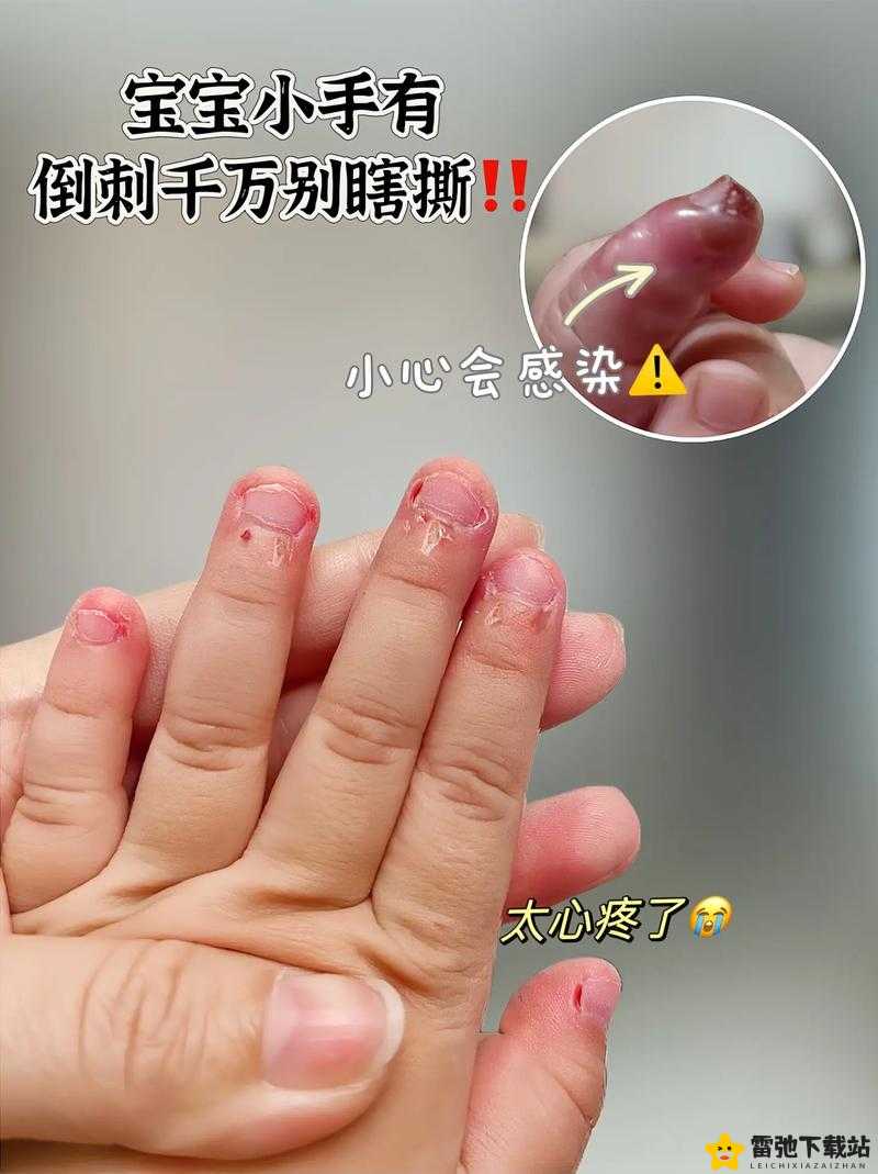 宝宝下面都湿透了还嘴硬疼 你怎么解释